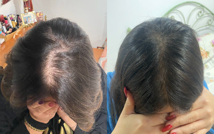 Una nostra cliente, dopo un mese di utilizzo del kit anticaduta capelli. Che risultato!