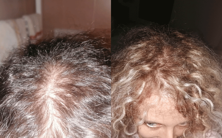 Francesca da 2 mesi utilizza il nostro integratore per capelli. La crescita è considerevole.