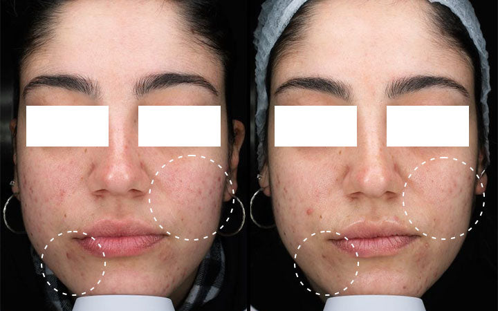 Filtro Freewell Per DJI Air 3S - Riduzione Inquinamento Luminoso Per Foto E Video Notturni Nitidi - Foto 7