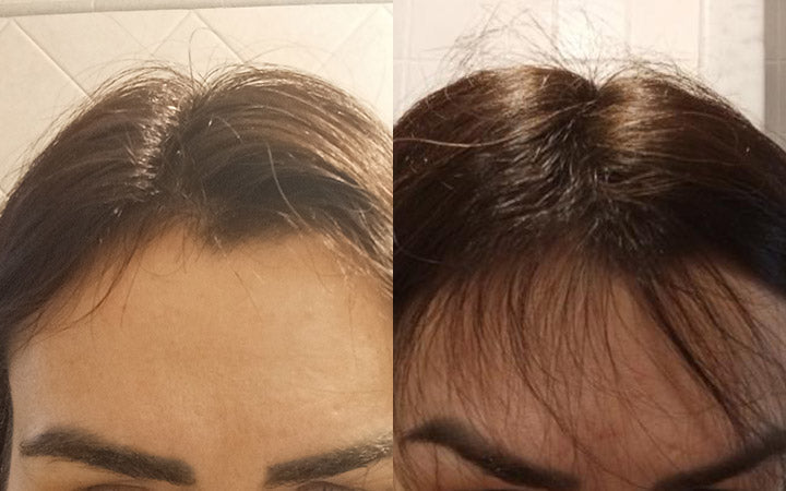 Risultati dopo 4 mesi di Tricostrong®