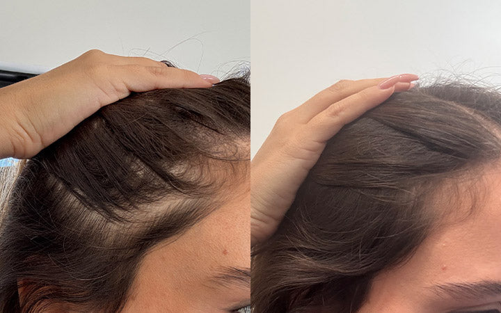 Risultati dopo 4 mesi di Tricostrong®