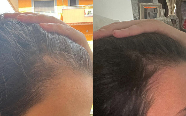 Risultati dopo 1 mese e mezzo di Tricostrong® - Stanartis