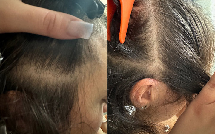 Risultati dopo 6 Mesi con le compresse Tricostrong®