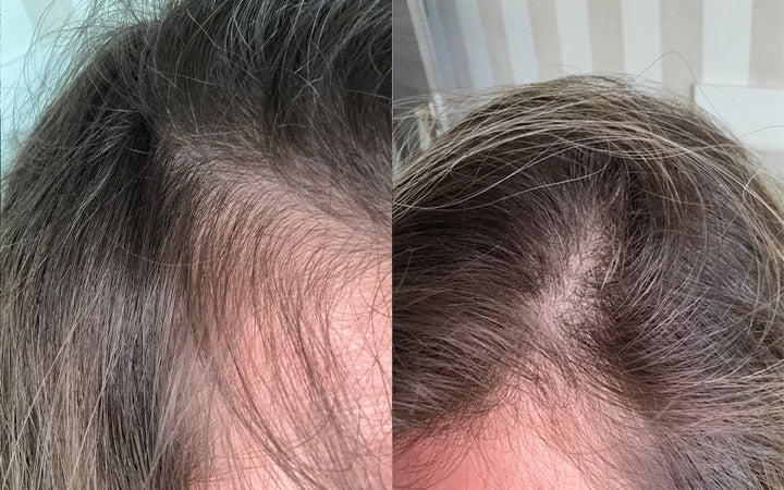 Risultati dopo 6 mesi di Tricostrong®