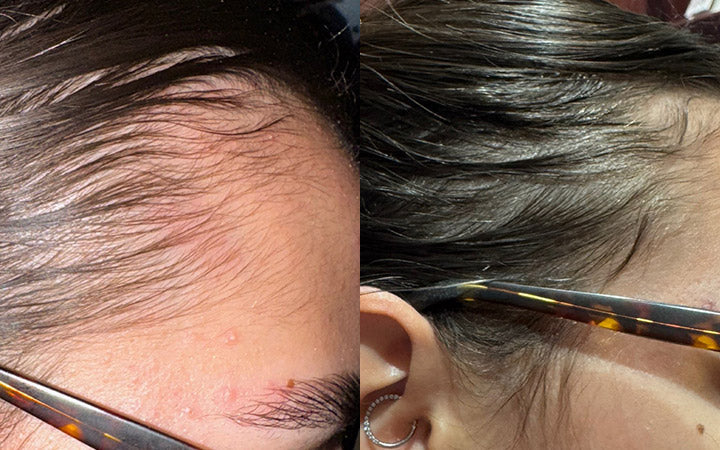 Risultati prima e dopo l'utilizzo di Tricostrong®