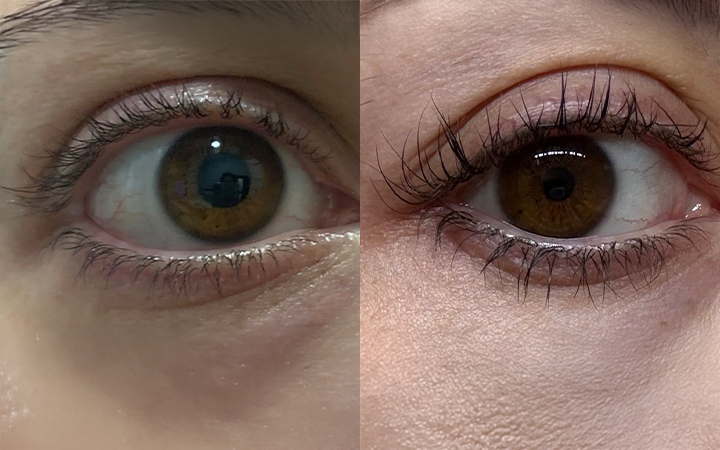 Risultati prima e dopo con Starlash Siero Ciglia e Sopracciglia