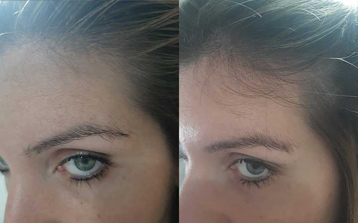 Prima e dopo 2 mesi di trattamento con le compresse Nutricum